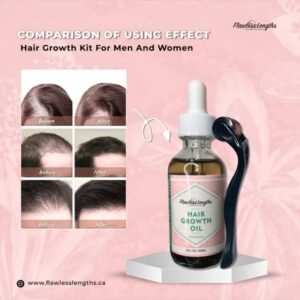Hair Growth Oil and Micro Needler